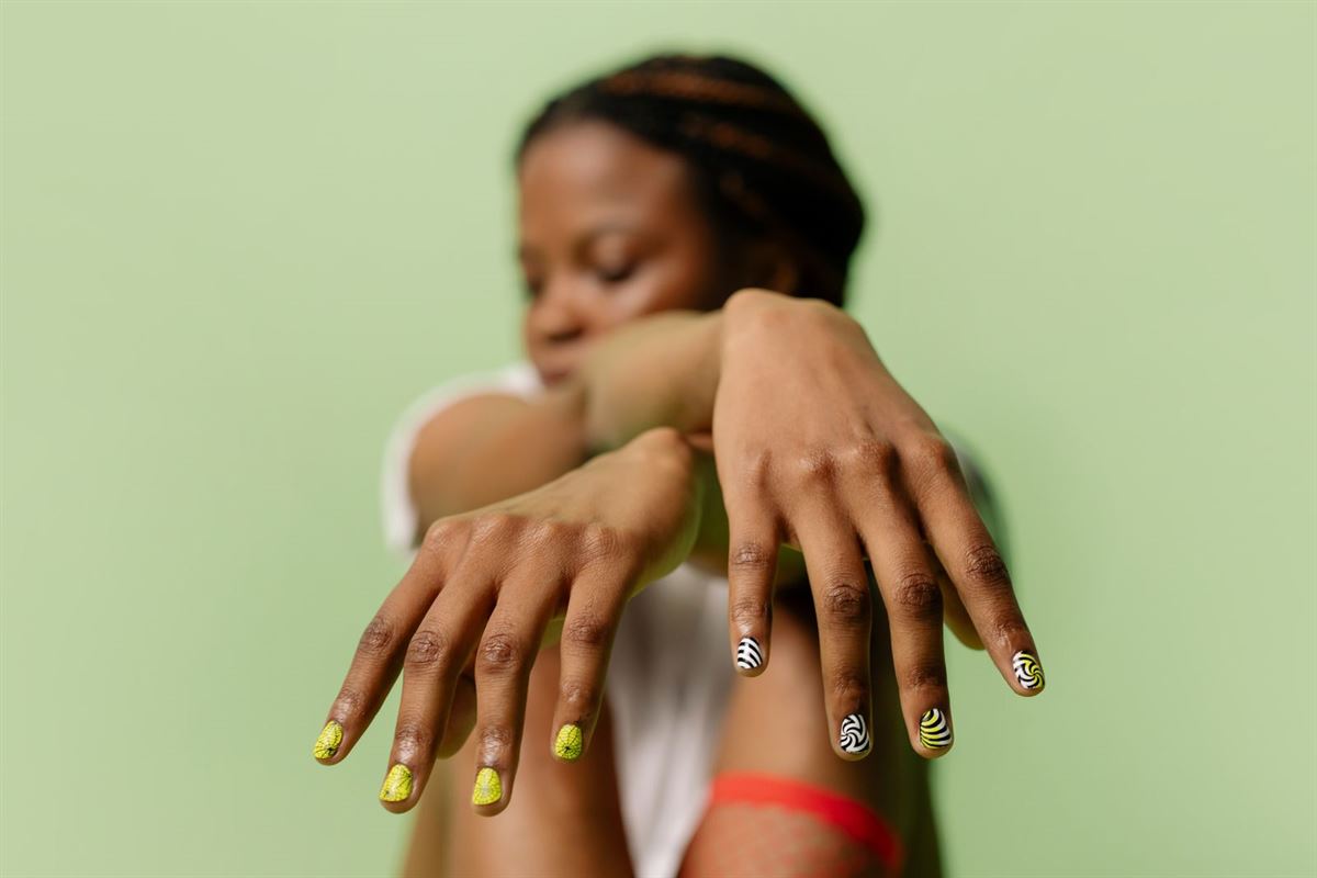 Two hands showing hand-painted yellow and zebra-stripe nail art